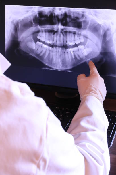Best Emergency Treatment for Dental Infections or Abscesses in Highland Rk, PA